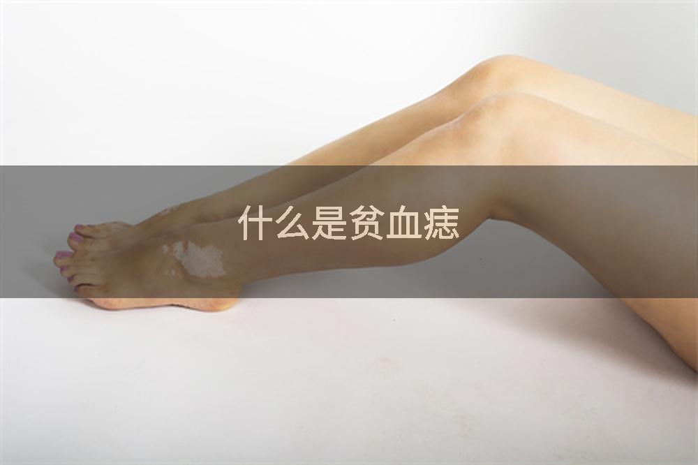 什么是贫血痣