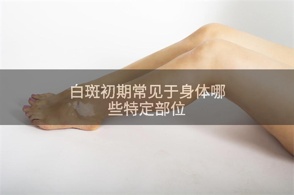 白斑初期常见于身体哪些特定部位