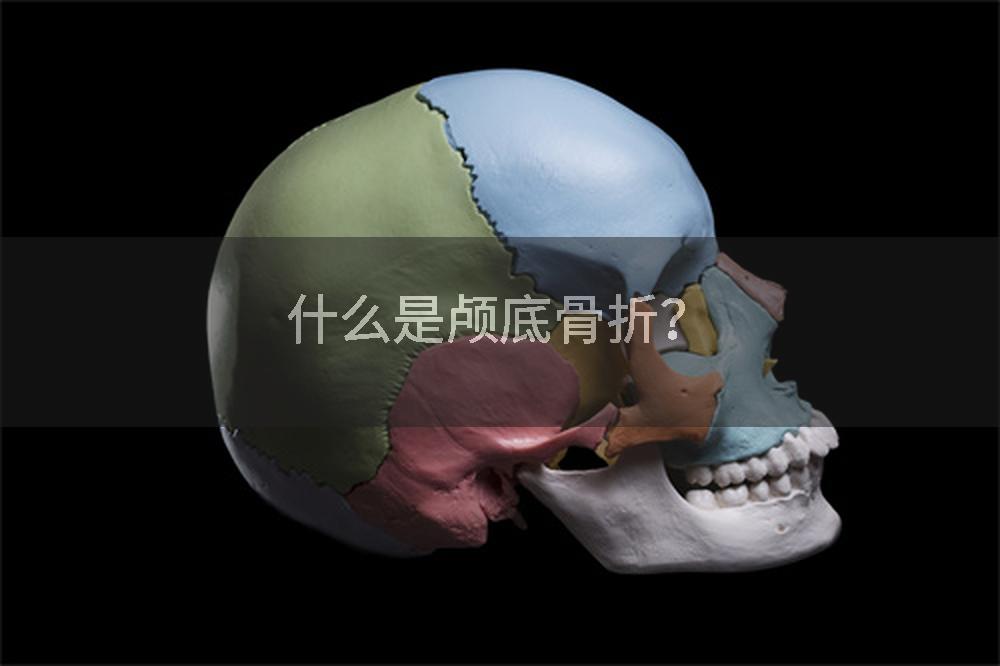 什么是颅底骨折？