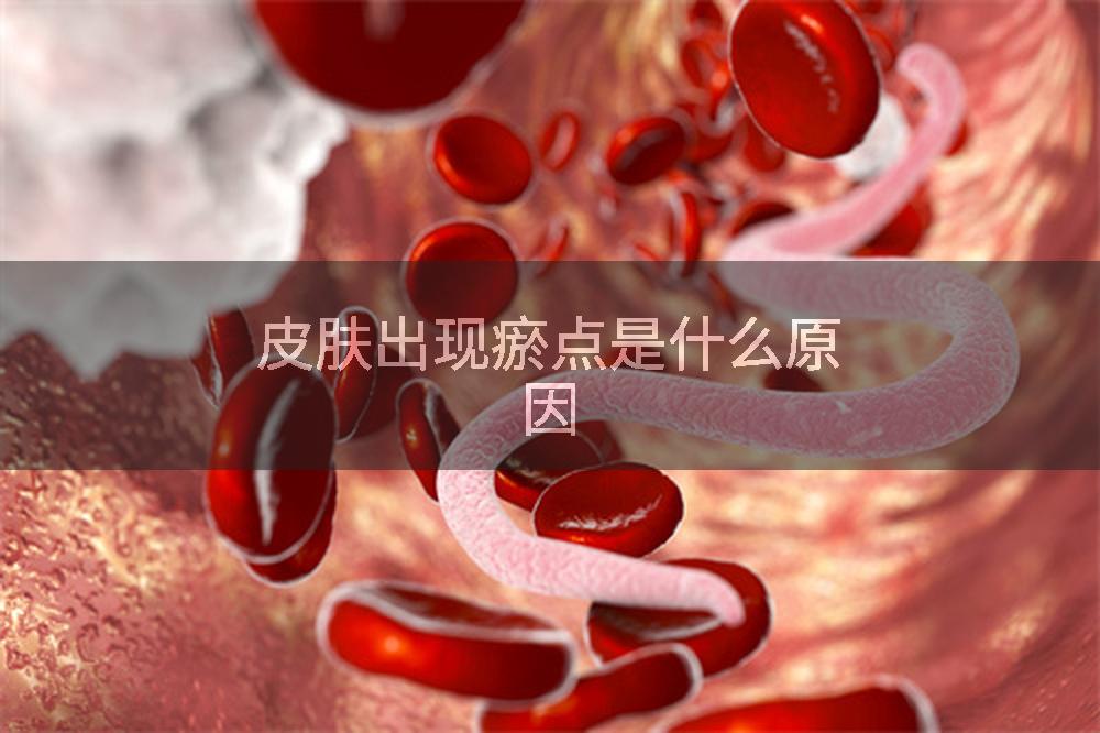 皮肤出现瘀点是什么原因