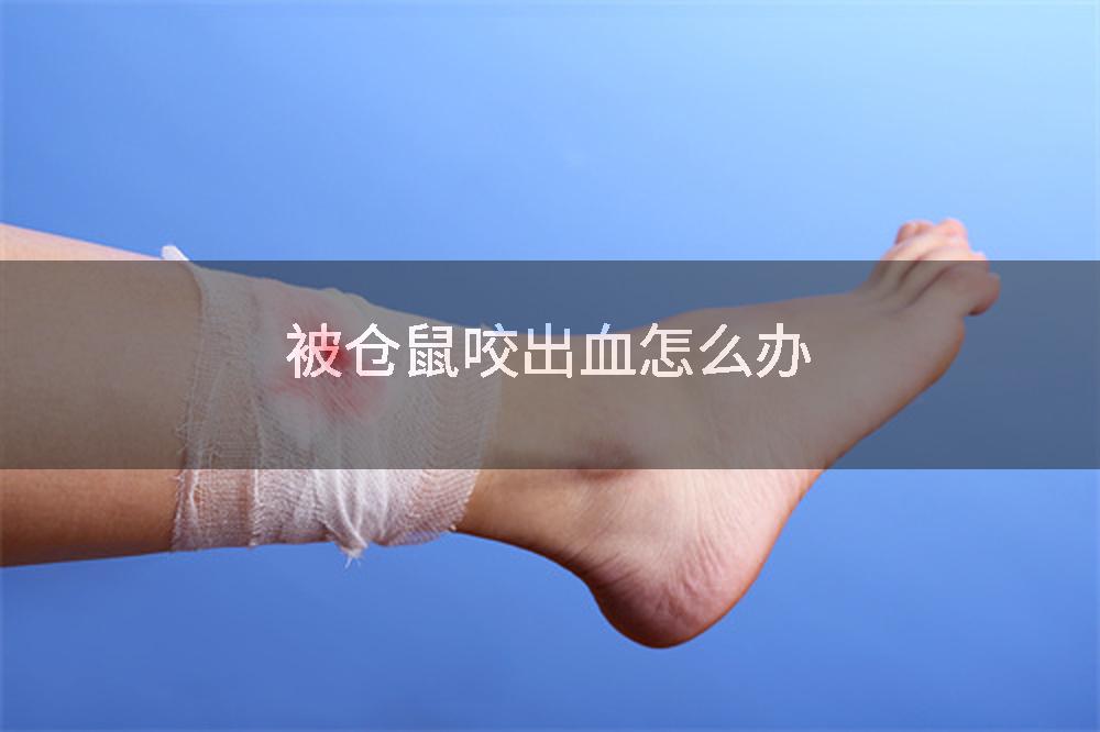 被仓鼠咬出血怎么办