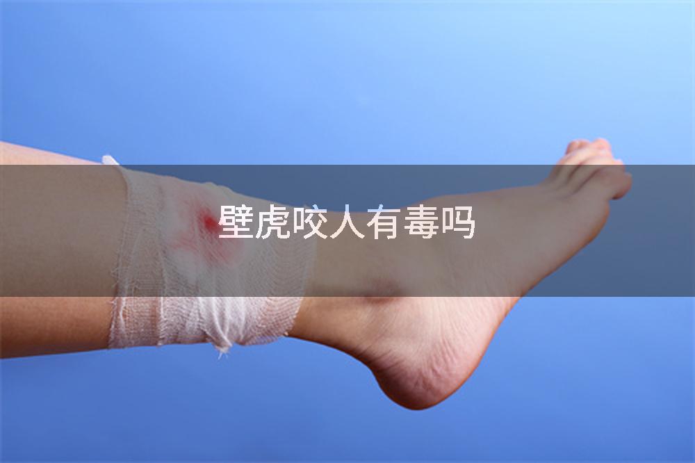 壁虎咬人有毒吗