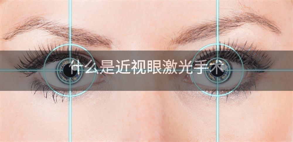 什么是近视眼激光手术