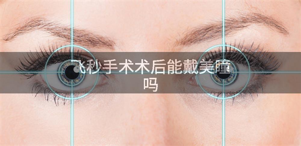 飞秒手术术后能戴美瞳吗