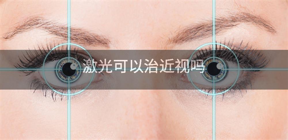 激光可以治近视吗