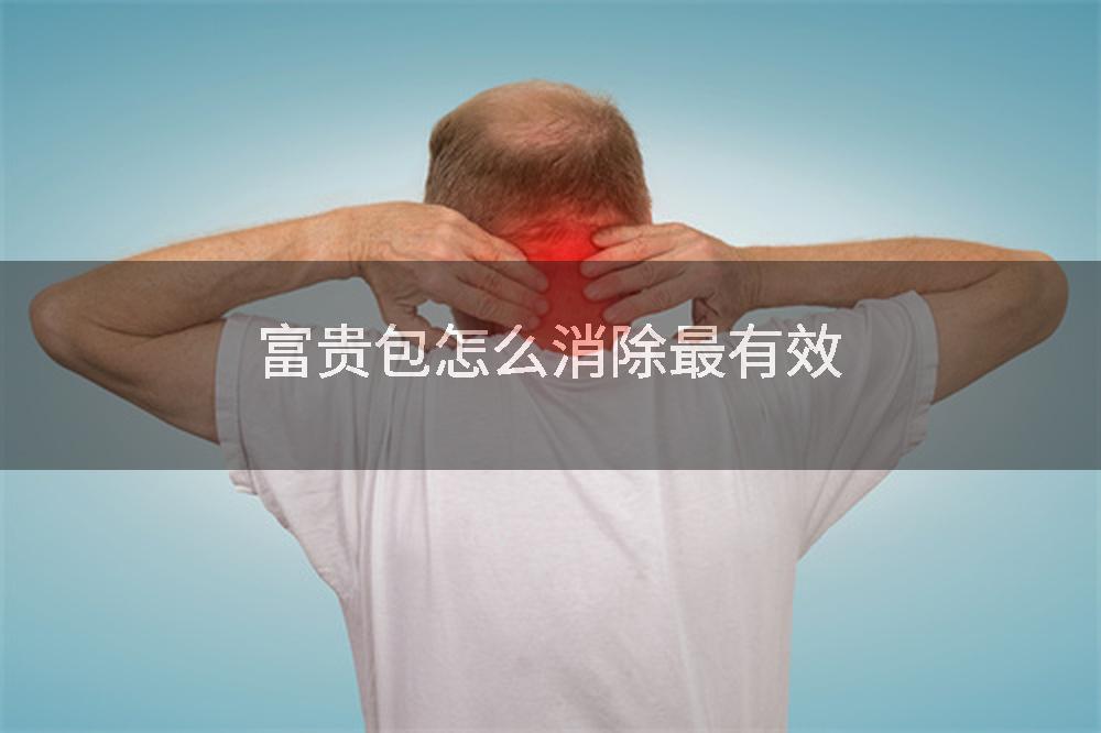 富贵包怎么消除最有效