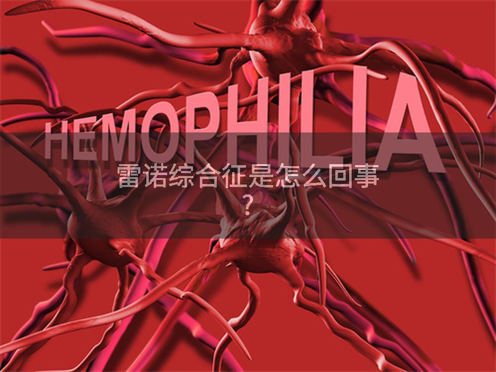 雷诺综合征是怎么回事?