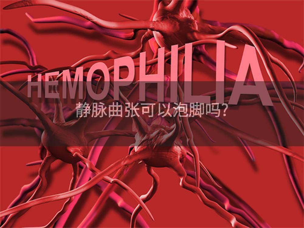 静脉曲张可以泡脚吗?