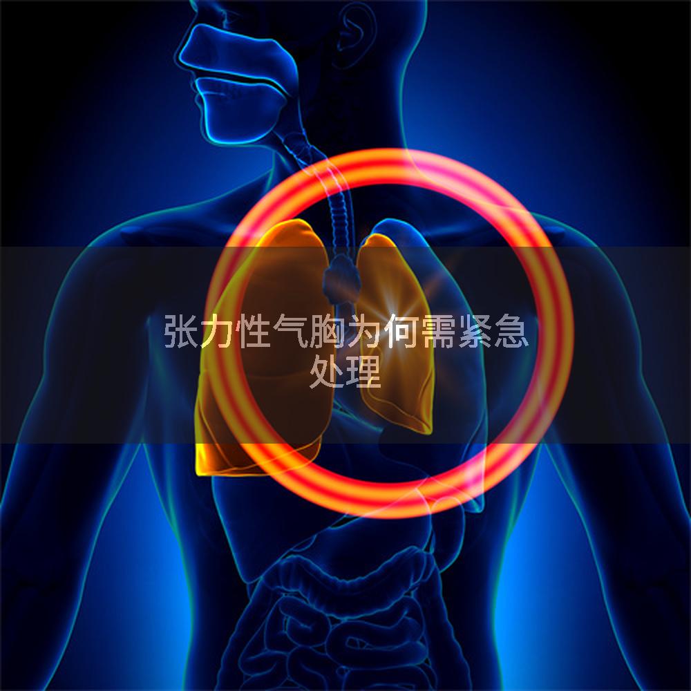 张力性气胸为何需紧急处理