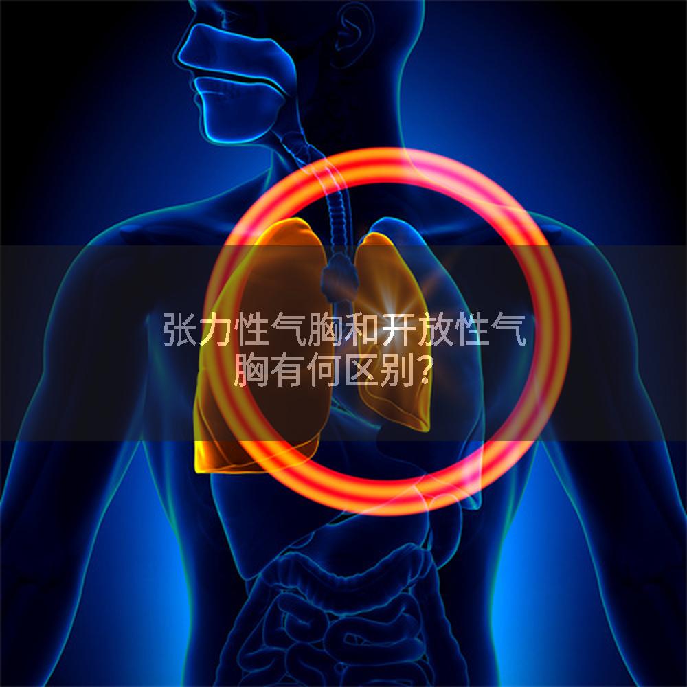 张力性气胸和开放性气胸有何区别？
