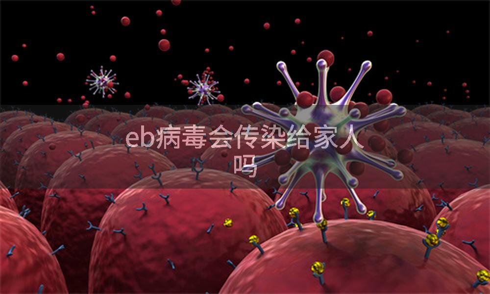 eb病毒会传染给家人吗