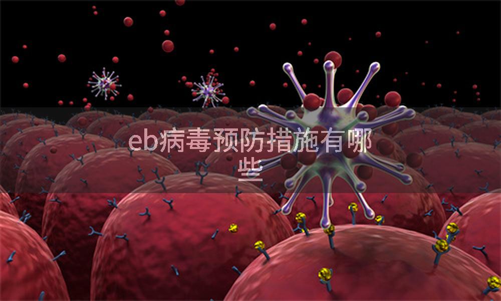 eb病毒预防措施有哪些