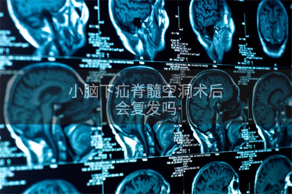 小脑下疝脊髓空洞术后会复发吗