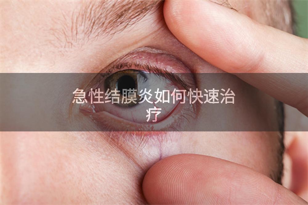 急性结膜炎如何快速治疗