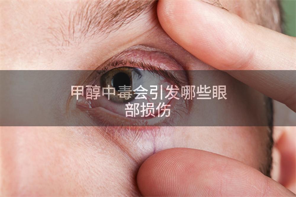 甲醇中毒会引发哪些眼部损伤