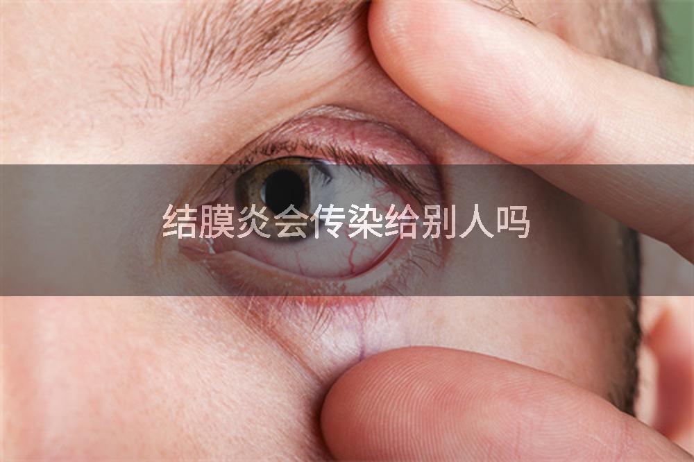 结膜炎会传染给别人吗