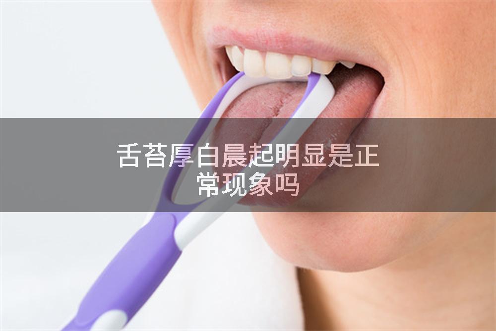 舌苔厚白晨起明显是正常现象吗