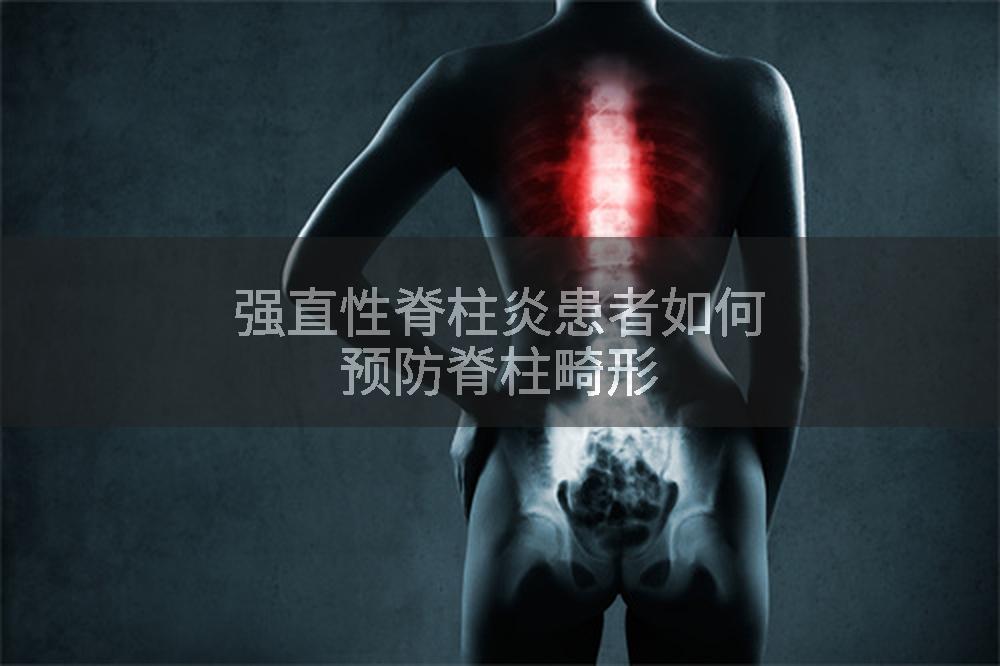 强直性脊柱炎患者如何预防脊柱畸形
