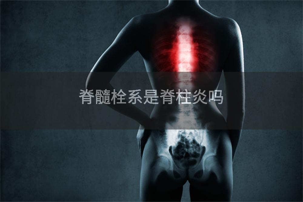 脊髓栓系是脊柱炎吗