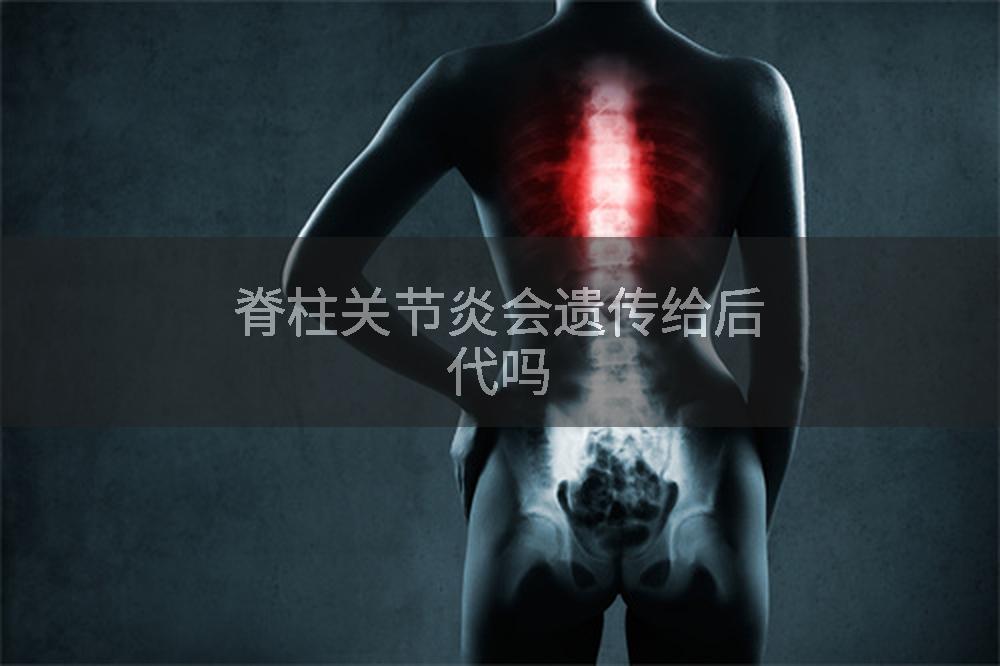 脊柱关节炎会遗传给后代吗