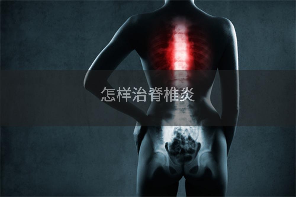 怎样治脊椎炎