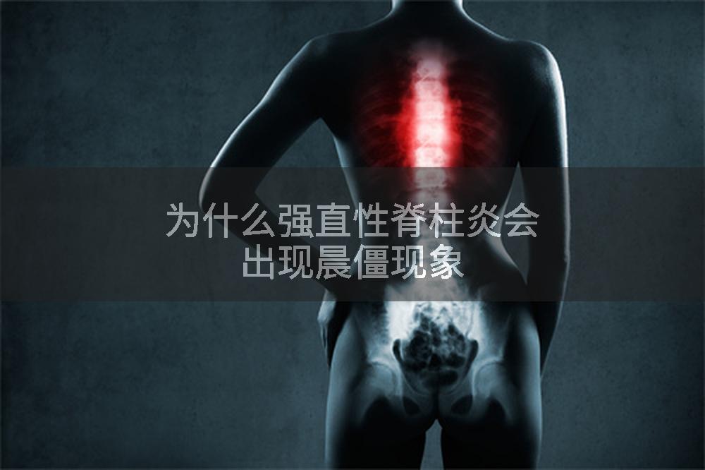 为什么强直性脊柱炎会出现晨僵现象