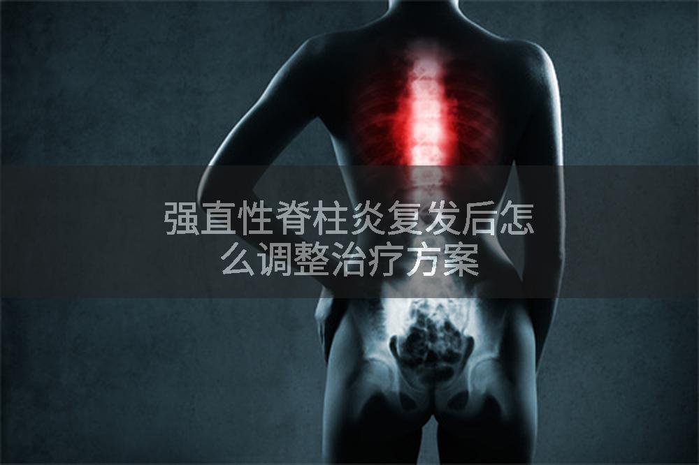 强直性脊柱炎复发后怎么调整治疗方案