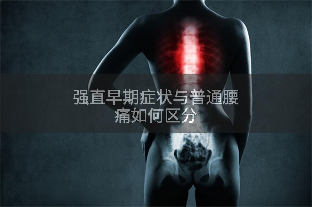 强直早期症状与普通腰痛如何区分