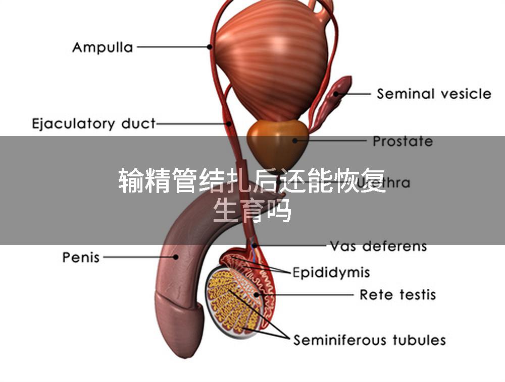 输精管结扎后还能恢复生育吗