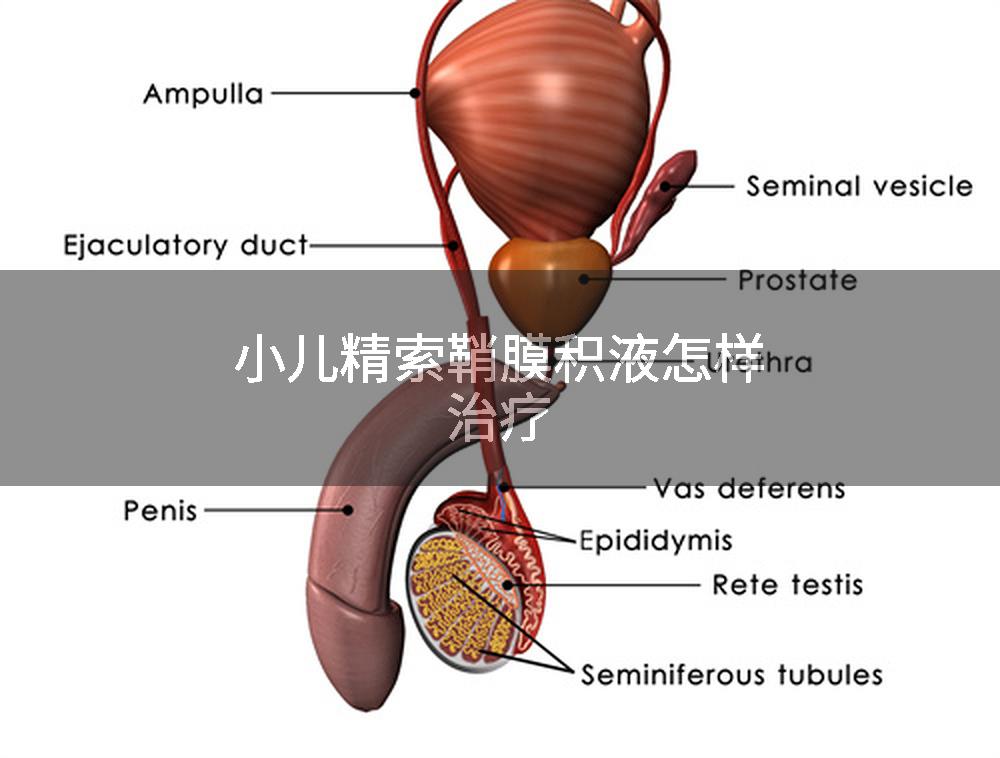 小儿精索鞘膜积液怎样治疗