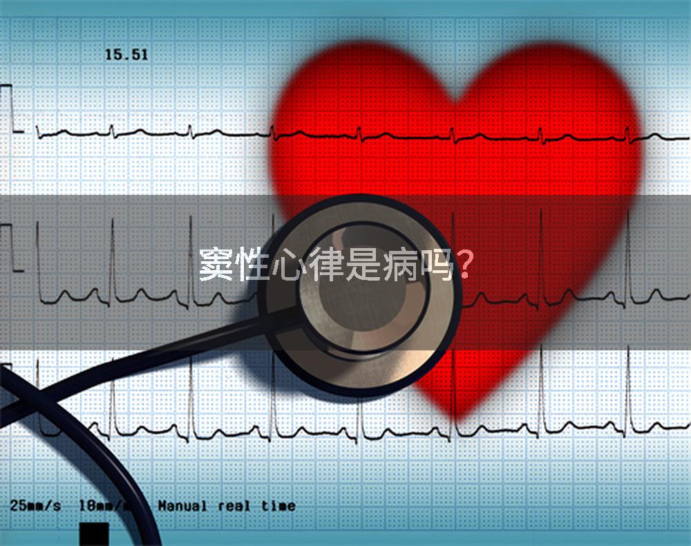 窦性心律是病吗?