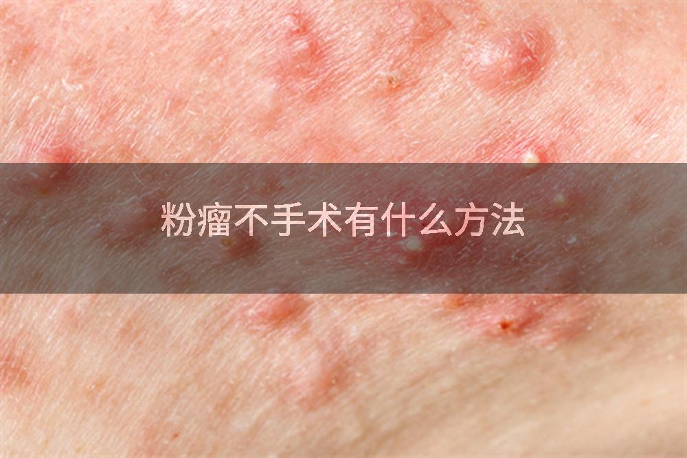 粉瘤不手术有什么方法