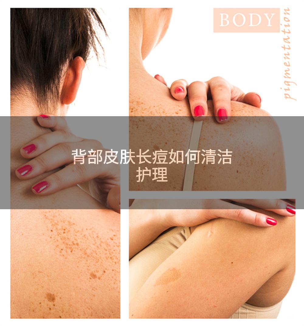 背部皮肤长痘如何清洁护理