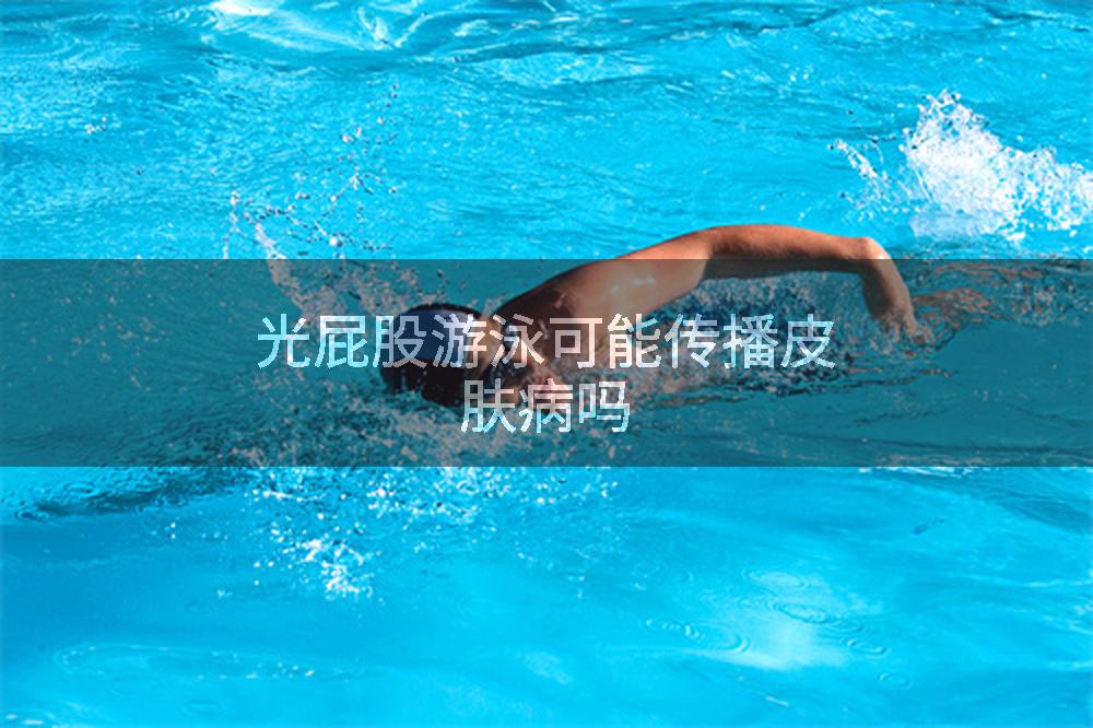 光屁股游泳可能传播皮肤病吗
