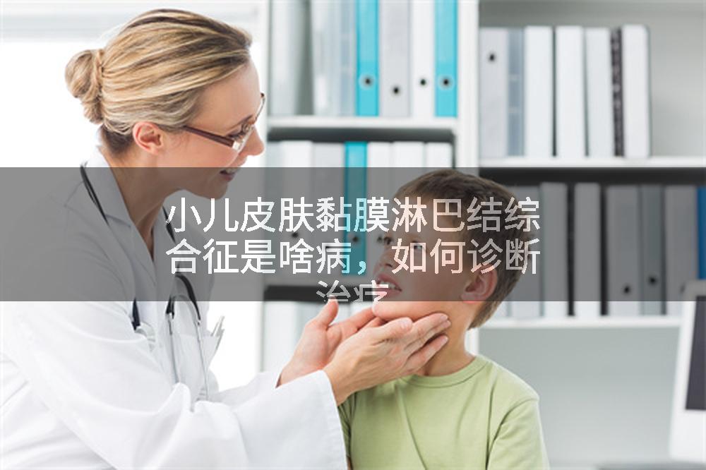 小儿皮肤黏膜淋巴结综合征是啥病，如何诊断治疗