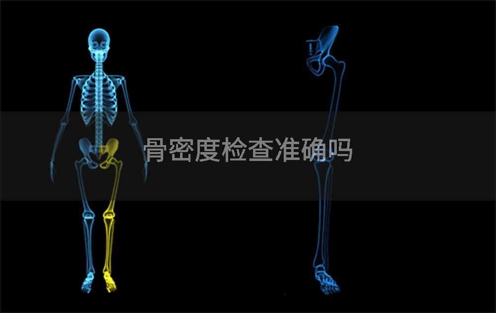 骨密度检查准确吗