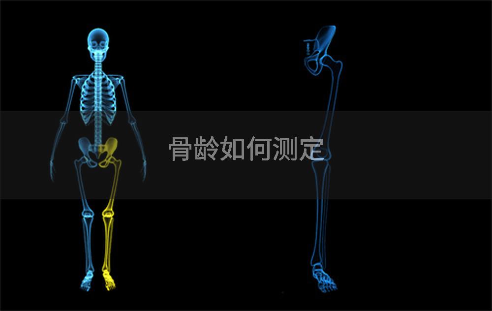 骨龄如何测定