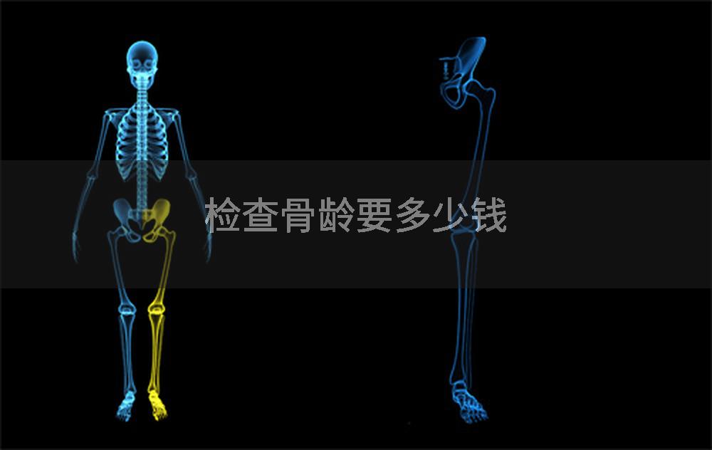 检查骨龄要多少钱
