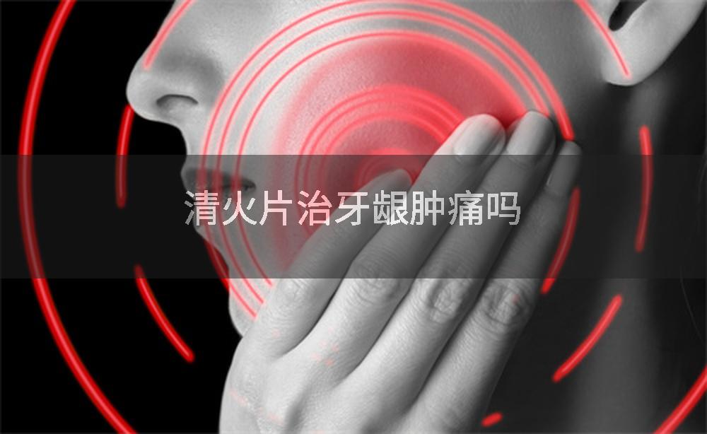 清火片治牙龈肿痛吗