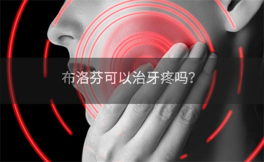 布洛芬可以治牙疼吗？