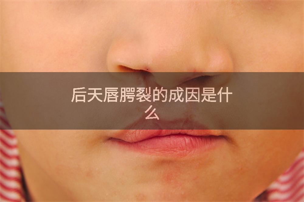 后天唇腭裂的成因是什么
