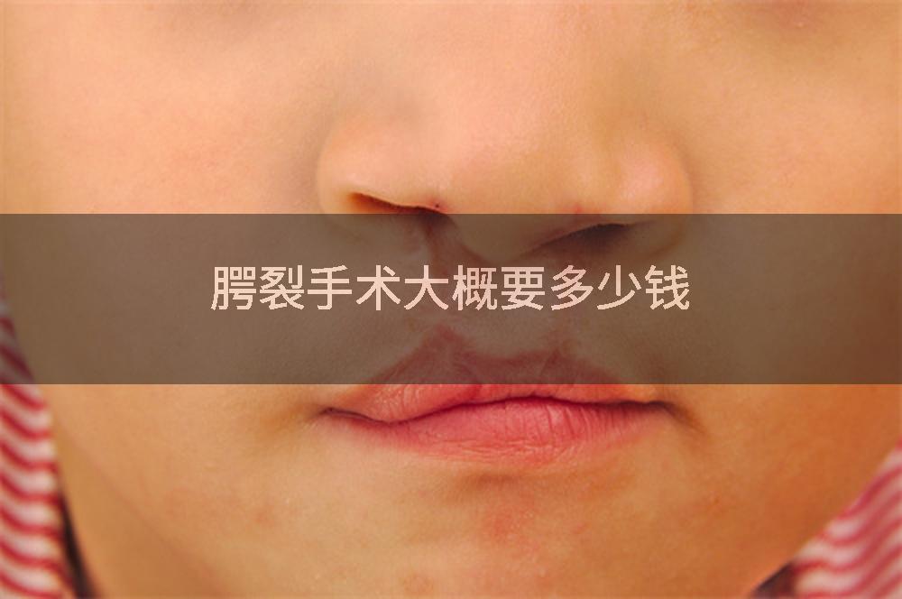 腭裂手术大概要多少钱