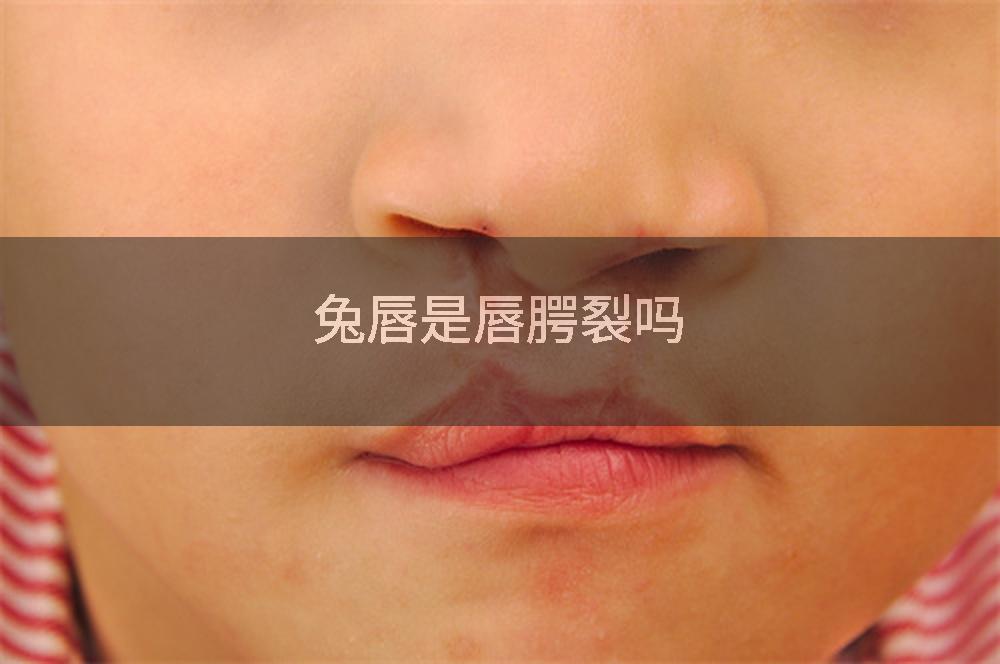 兔唇是唇腭裂吗