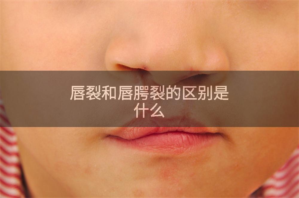 唇裂和唇腭裂的区别是什么