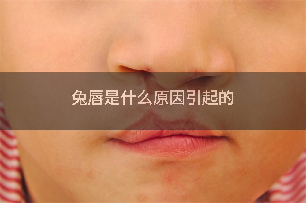 兔唇是什么原因引起的