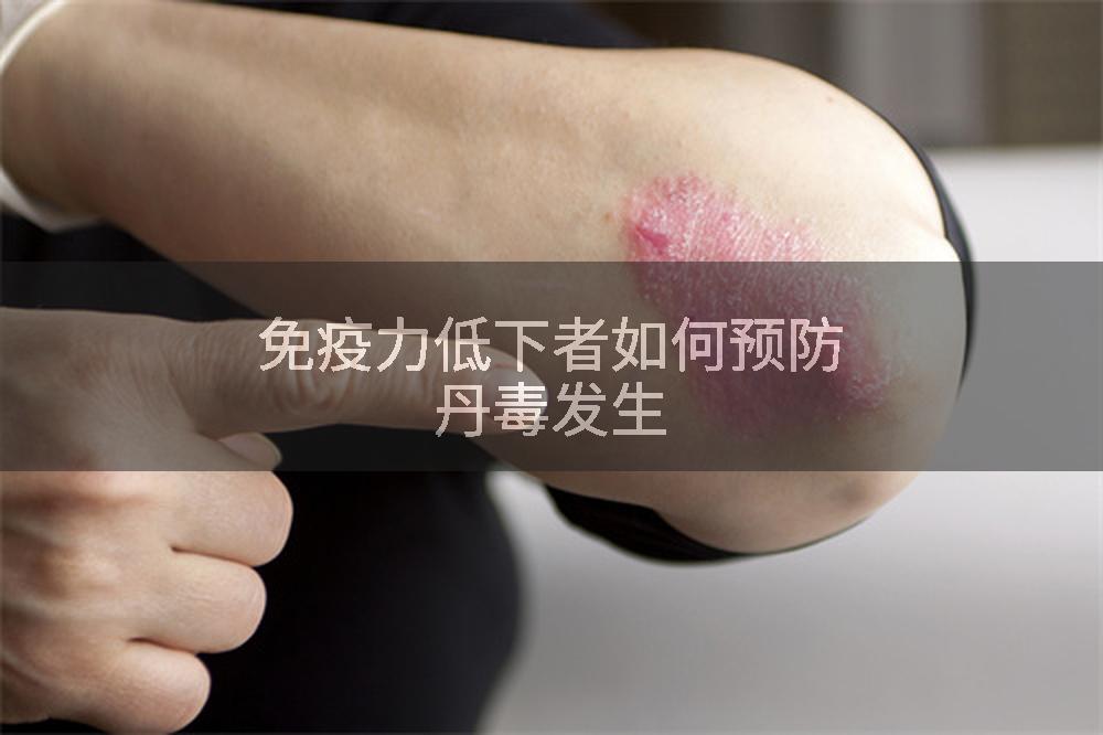 免疫力低下者如何预防丹毒发生