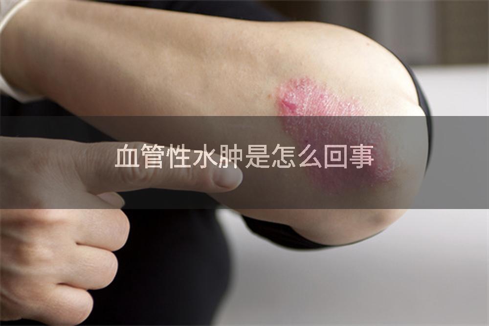 血管性水肿是怎么回事