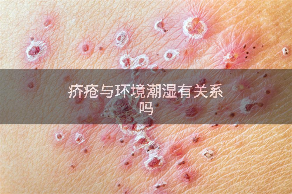疥疮与环境潮湿有关系吗