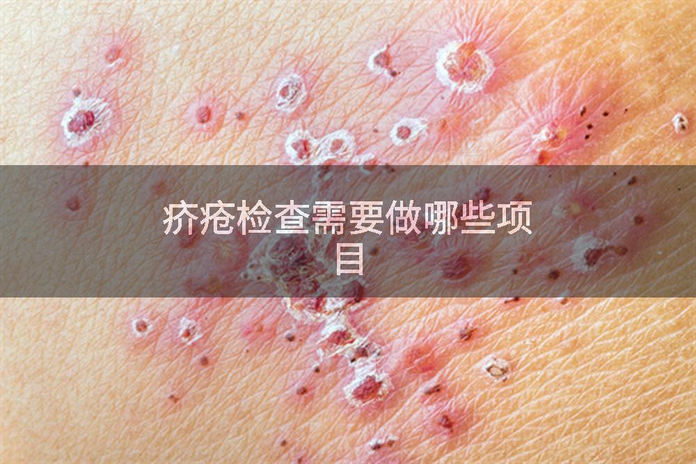 疥疮检查需要做哪些项目