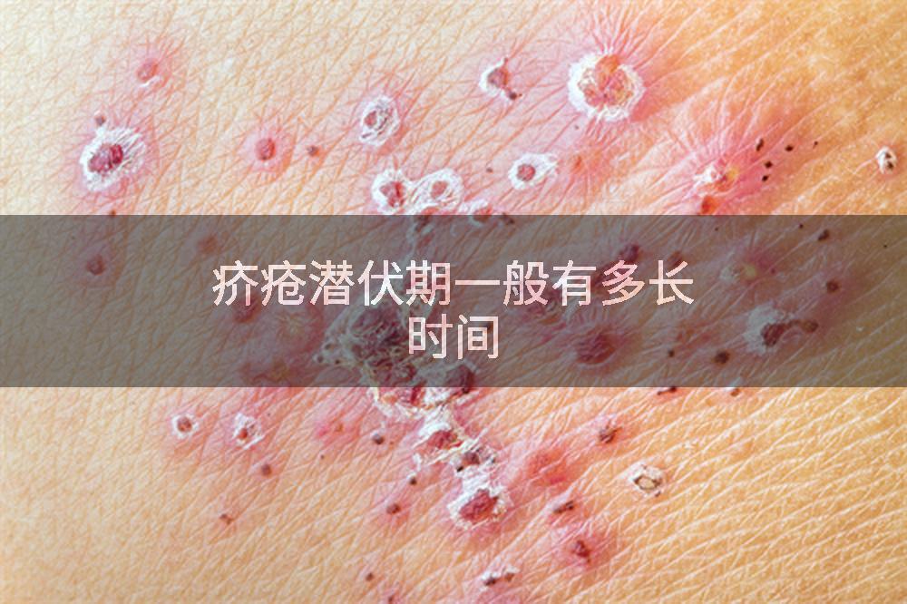 疥疮潜伏期一般有多长时间